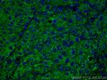 SERPINA7 Antibody in Immunohistochemistry (PFA fixed) (IHC (PFA))