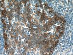 EGFR Antibody in Immunohistochemistry (Paraffin) (IHC (P))