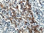 EGFR Antibody in Immunohistochemistry (Paraffin) (IHC (P))