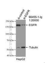 EGFR Antibody in Western Blot (WB)