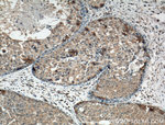EGFR Antibody in Immunohistochemistry (Paraffin) (IHC (P))