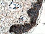 EGFR Antibody in Immunohistochemistry (Paraffin) (IHC (P))