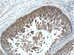 EGFR Antibody in Immunohistochemistry (Paraffin) (IHC (P))