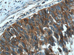 EGFR Antibody in Immunohistochemistry (Paraffin) (IHC (P))