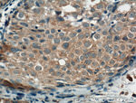 EGFR Antibody in Immunohistochemistry (Paraffin) (IHC (P))