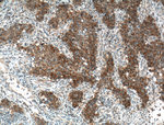 EGFR Antibody in Immunohistochemistry (Paraffin) (IHC (P))