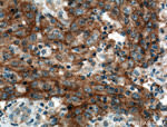 EGFR Antibody in Immunohistochemistry (Paraffin) (IHC (P))