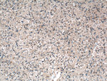 EGFR Antibody in Immunohistochemistry (Paraffin) (IHC (P))