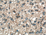 EGFR Antibody in Immunohistochemistry (Paraffin) (IHC (P))