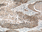 EGFR Antibody in Immunohistochemistry (Paraffin) (IHC (P))