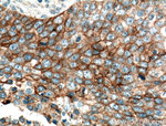 EGFR Antibody in Immunohistochemistry (Paraffin) (IHC (P))