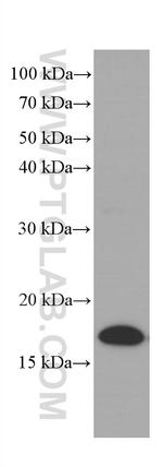Lysozyme Antibody in Western Blot (WB)