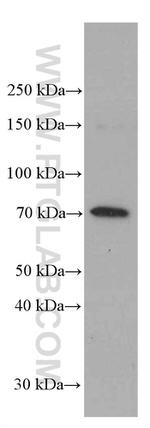 FOXO1 Antibody in Western Blot (WB)