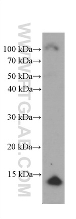 CRABP2 Antibody in Western Blot (WB)