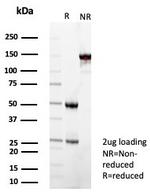 Superoxide Dismutase 1 (SOD1) (Antioxidant Enzyme) Antibody in SDS-PAGE (SDS-PAGE)