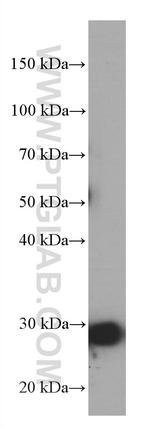 MEA1 Antibody in Western Blot (WB)