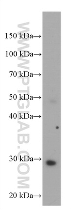 MEA1 Antibody in Western Blot (WB)