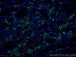 PSAP Antibody in Immunohistochemistry (PFA fixed) (IHC (PFA))