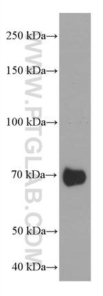 PSAP Antibody in Western Blot (WB)
