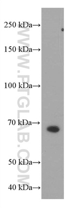 PSAP Antibody in Western Blot (WB)