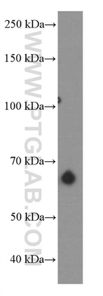 PSAP Antibody in Western Blot (WB)