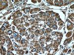 SOD2 Antibody in Immunohistochemistry (Paraffin) (IHC (P))