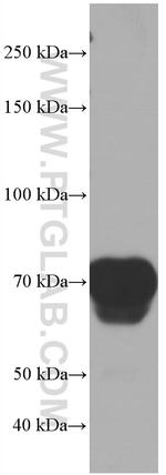 Hemopexin Antibody in Western Blot (WB)