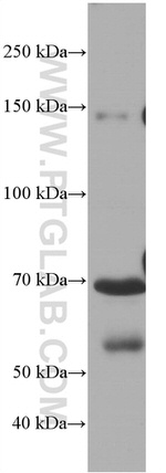 Hemopexin Antibody in Western Blot (WB)