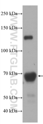 Hemopexin Antibody in Western Blot (WB)