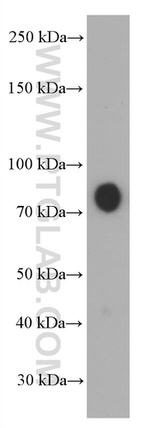 Hemopexin Antibody in Western Blot (WB)
