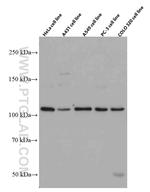 STAT2 Antibody in Western Blot (WB)