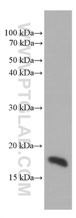 SURVIVIN Antibody in Western Blot (WB)