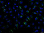 Calretinin Antibody in Immunocytochemistry (ICC/IF)