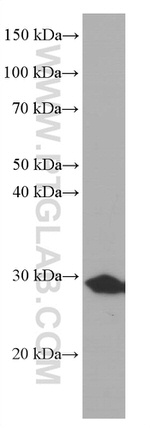 Calretinin Antibody in Western Blot (WB)