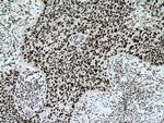 CCAR2 Antibody in Immunohistochemistry (Paraffin) (IHC (P))