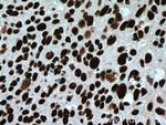 CCAR2 Antibody in Immunohistochemistry (Paraffin) (IHC (P))