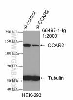 CCAR2 Antibody in Western Blot (WB)