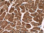 PCCB Antibody in Immunohistochemistry (Paraffin) (IHC (P))