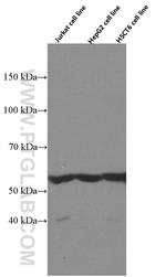 PCCB Antibody in Western Blot (WB)