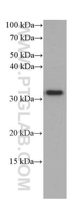 CD40L/CD154 Antibody in Western Blot (WB)