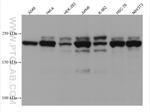 CNOT1 Antibody in Western Blot (WB)