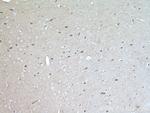 MKS1 Antibody in Immunohistochemistry (Paraffin) (IHC (P))