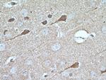 MKS1 Antibody in Immunohistochemistry (Paraffin) (IHC (P))