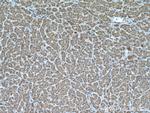 MKS1 Antibody in Immunohistochemistry (Paraffin) (IHC (P))