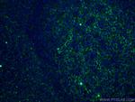 CD11B/Integrin alpha M Antibody in Immunohistochemistry (PFA fixed) (IHC (PFA))