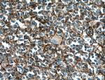 CD11B/Integrin alpha M Antibody in Immunohistochemistry (Paraffin) (IHC (P))