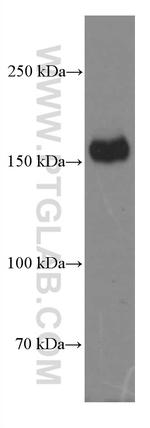 CD11B/Integrin alpha M Antibody in Western Blot (WB)