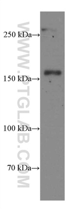 CD11B/Integrin alpha M Antibody in Western Blot (WB)