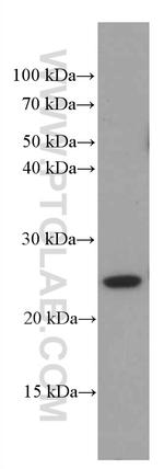 Recoverin Antibody in Western Blot (WB)