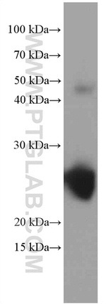 Recoverin Antibody in Western Blot (WB)